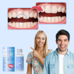 KIT DE REPARAÇÃO DE DENTES INSTASMILE
